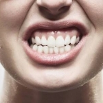 Dentistas em Santos - Thumb - Saiba mais sobre o Bruxismo