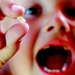 Dentistas em Santos - Thumb - Caries não tratadas em dentes de leite podem afetar os dentes permanentes