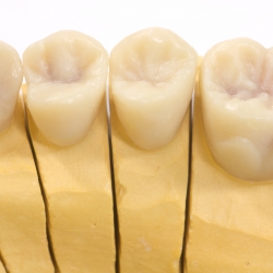 Dentistas em Santos - Fixas