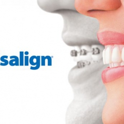 Dentistas em Santos - Invisalign